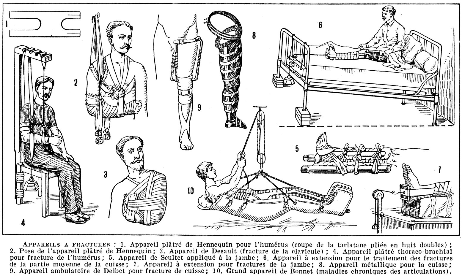 Schwarz-weiß-Zeichnung eines Mannes im Krankenhausbett mit einem Gipsverband am Bein, umgeben von Bildern von Menschen, einer sitzenden Person und verschiedenen Gegenständen, mit der Beschriftung "Knochenbrüche am Arm und Bein" unten.