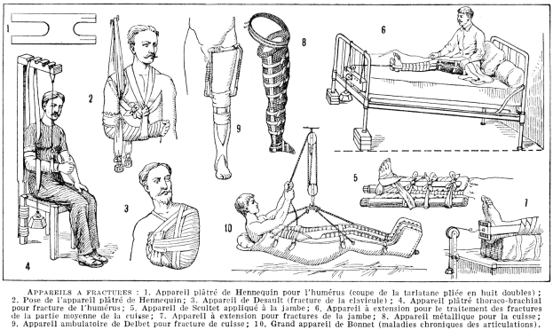 Schwarz-weiß-Zeichnung eines Mannes im Krankenhausbett mit einem Gipsverband am Bein, umgeben von Bildern von Menschen, einer sitzenden Person und verschiedenen Gegenständen, mit der Beschriftung "Knochenbrüche am Arm und Bein" unten.